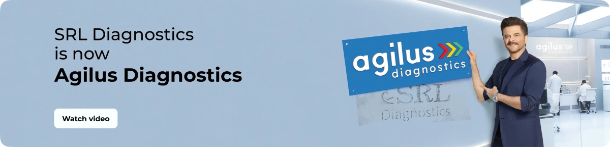 2-srl-agilus_desktop_compressed