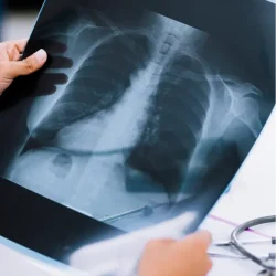 X-Ray